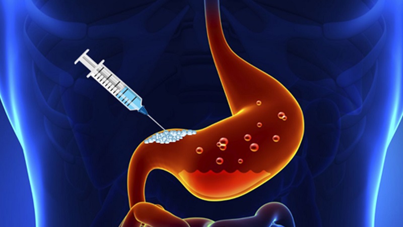 متخصص تغذیه تهران | رژیم غذایی آنلاین | دکتر مریم سبکتکین | بوتاکس معده