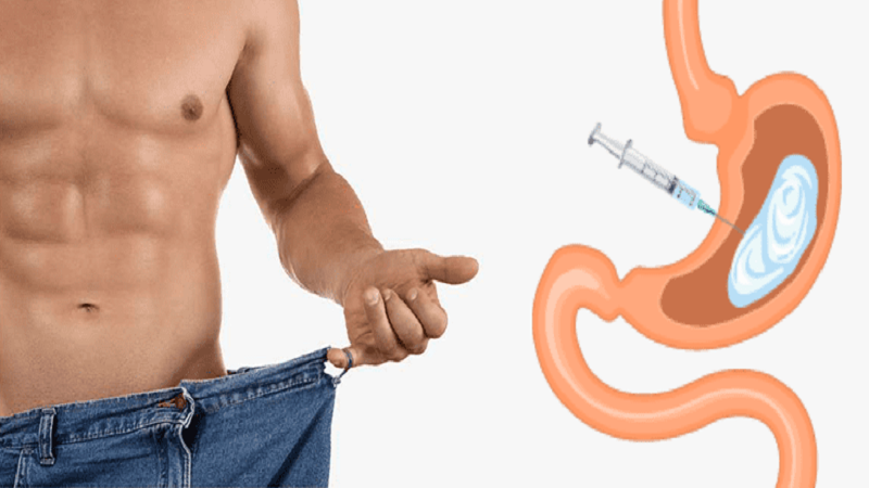 متخصص تغذیه تهران | رژیم غذایی آنلاین | دکتر مریم سبکتکین | نکات مرتبط با سبک زندگی و تغذیه بعد از بوتاکس معده