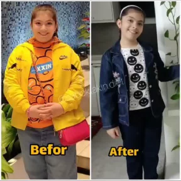 متخصص تغذیه تهران |رژیم درمانی و کاهش وزن در کودکان 